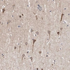 Anti-SPOCK1 Antibody