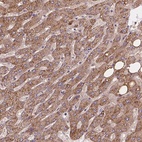 Anti-CDK10 Antibody