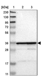 Lane 1: Marker [kDa] 230, 130, 95, 72, 56, 36, 28, 17, 11_br/_Lane 2: Human cell line RT-4_br/_Lane 3: Human cell line U-251MG sp