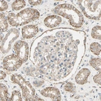 Anti-CDH6 Antibody