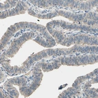Immunohistochemical staining of human fallopian tube shows moderate membranous and cytoplasmic positivity in cells in glandular cells.