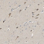 Immunohistochemical staining of human cerebral cortex shows moderate cytoplasmic positivity in neurons.