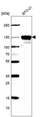 Western blot analysis in human cell line EFO-21.
