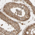 Immunohistochemical staining of human testis shows moderate cytoplasmic positivity in cells in seminiferous ducts.