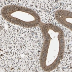 Immunohistochemical staining of human endometrium shows moderate cytoplasmic positivity in glandular cells.