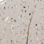 Immunohistochemical staining of human cerebral cortex shows moderate cytoplasmic positivity in neurons.