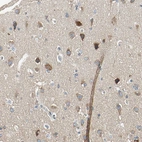 Immunohistochemical staining of human cerebral cortex shows moderate cytoplasmic positivity in neurons.