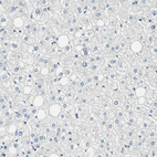 Immunohistochemical staining of human liver shows no positivity in hepatocytes as expected.