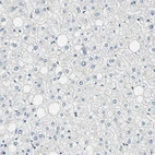 Immunohistochemical staining of human liver shows no positivity in hepatocytes as expected.