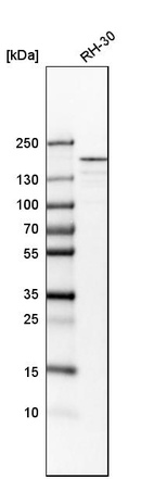 Western blot analysis in human cell line RH-30.