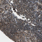 Anti-CAPZA2 Antibody