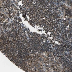 Anti-CAPZA2 Antibody