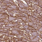 Immunohistochemical staining of human heart muscle shows strong membranous positivity in cardiomyocytes.