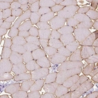 Immunohistochemical staining of human skeletal muscle shows strong membranous positivity in myocytes.