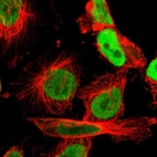 Immunofluorescent staining of human cell line U-251 MG shows localization to nucleoplasm.