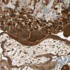 Immunohistochemical staining of human placenta shows strong cytoplasmic positivity in trophoblastic and decidual cells.