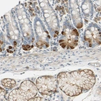 Immunohistochemical staining of human duodenum shows moderate cytoplasmic positivity in glandular and enteroendocrine cells.