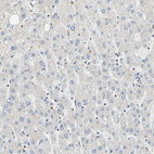 Immunohistochemical staining of human liver shows very weak cytoplasmic positivity in hepatocytes.