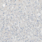 Anti-WIPI1 Antibody