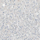 Immunohistochemical staining of human liver shows very weak cytoplasmic positivity in hepatocytes.