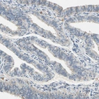 Immunohistochemical staining of human fallopian tube shows very weak cytoplasmic positivity in glandular cells.