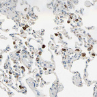 Anti-PLXNA1 Antibody