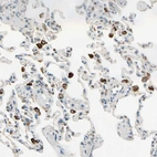 Anti-PLXNA1 Antibody