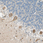 Immunohistochemical staining of human cerebellum shows moderate cytoplasmic positivity in Purkinje cells.
