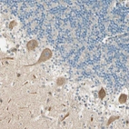Immunohistochemical staining of human cerebellum shows moderate cytoplasmic positivity in Purkinje cells.