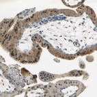 Immunohistochemical staining of human placenta shows moderate cytoplasmic positivity in trophoblastic cells.