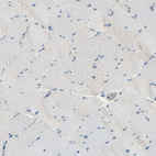 Immunohistochemical staining of human skeletal muscle shows no positivity in myocytes.