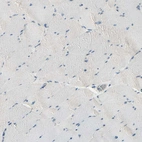 Immunohistochemical staining of human skeletal muscle shows no positivity in myocytes.