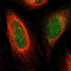 Immunofluorescent staining of human cell line U-2 OS shows localization to nucleus & cytosol.