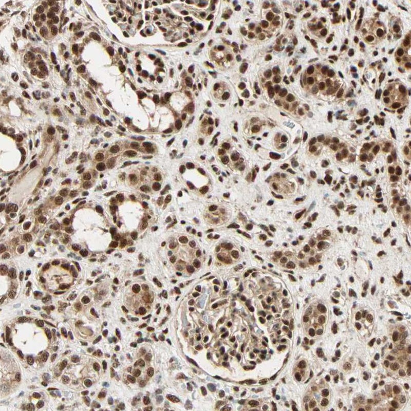 Anti-PNPLA6 Antibody
