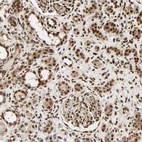 Anti-PNPLA6 Antibody