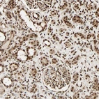 Anti-PNPLA6 Antibody