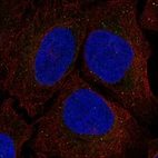 Anti-SRR Antibody