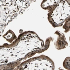 Immunohistochemical staining of human placenta shows strong nuclear positivity in trophoblastic cells.