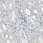 Immunohistochemical staining of human kidney shows moderate nuclear positivity in cells in glomeruli.