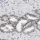 Immunohistochemical staining of human prostate shows moderate to strong nuclear positivity in glandular cells.