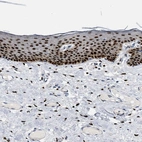 Immunohistochemical staining of human skin shows strong nuclear positivity in squamous epithelial cells.