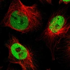 Immunofluorescent staining of human cell line U-251 MG shows localization to nucleoplasm.