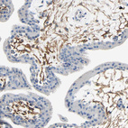 Immunohistochemical staining of human placenta shows moderate membranous positivity in endothelial cells.