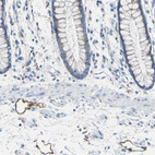 Immunohistochemical staining of human rectum shows moderate membranous positivity in endothelium of lymphatic vessels.