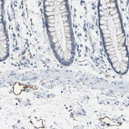 Immunohistochemical staining of human rectum shows moderate membranous positivity in endothelium of lymphatic vessels.