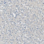 Immunohistochemical staining of human liver shows no positivity in hepatocytes as expected.