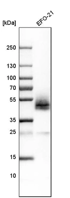 Western blot analysis in human cell line EFO-21.