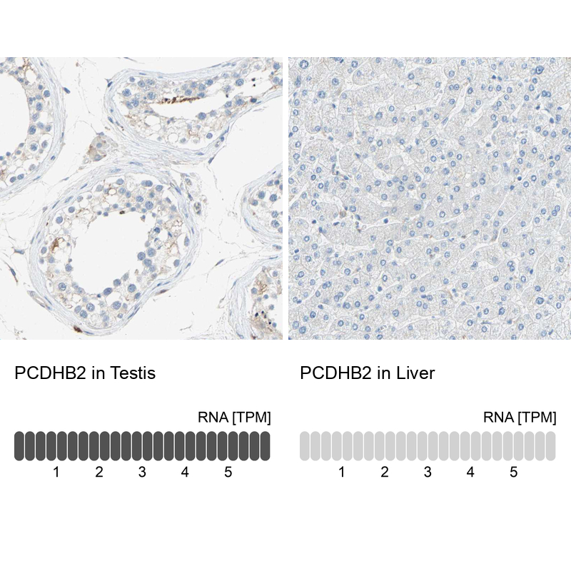 Anti-PCDHB2 Antibody