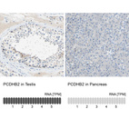 Anti-PCDHB2 Antibody