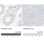 Anti-PCDHB2 Antibody